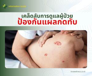 ป้องกันแผลกดทับ
