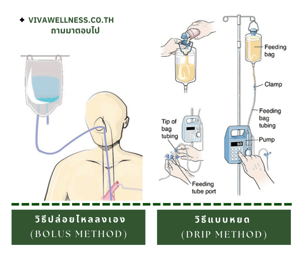 ท้องเสียจากอาหารปั่นผสม