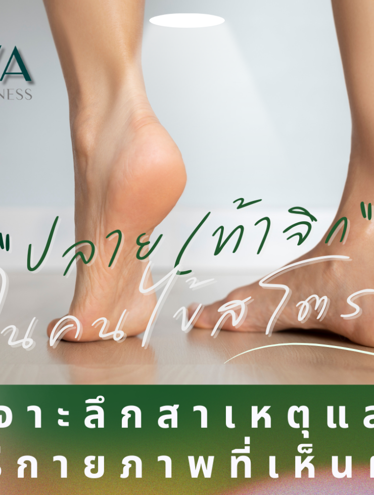 ปลายเท้าจิกในคนไข้สโตรก