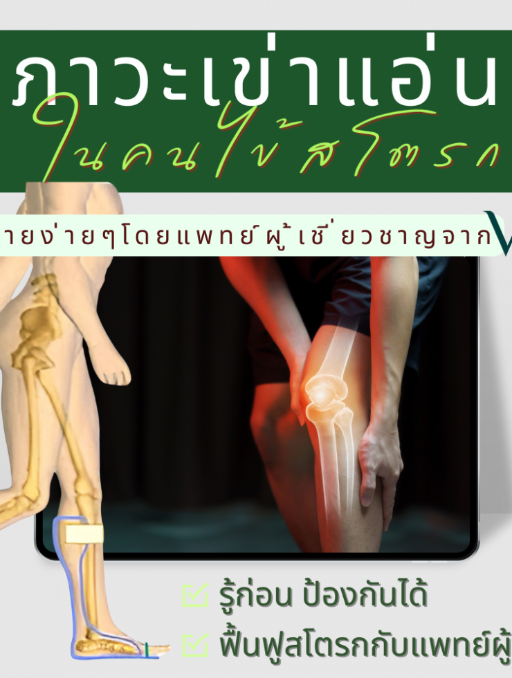 ภาวะเข่าแอ่นในคนไข้สโตรก
