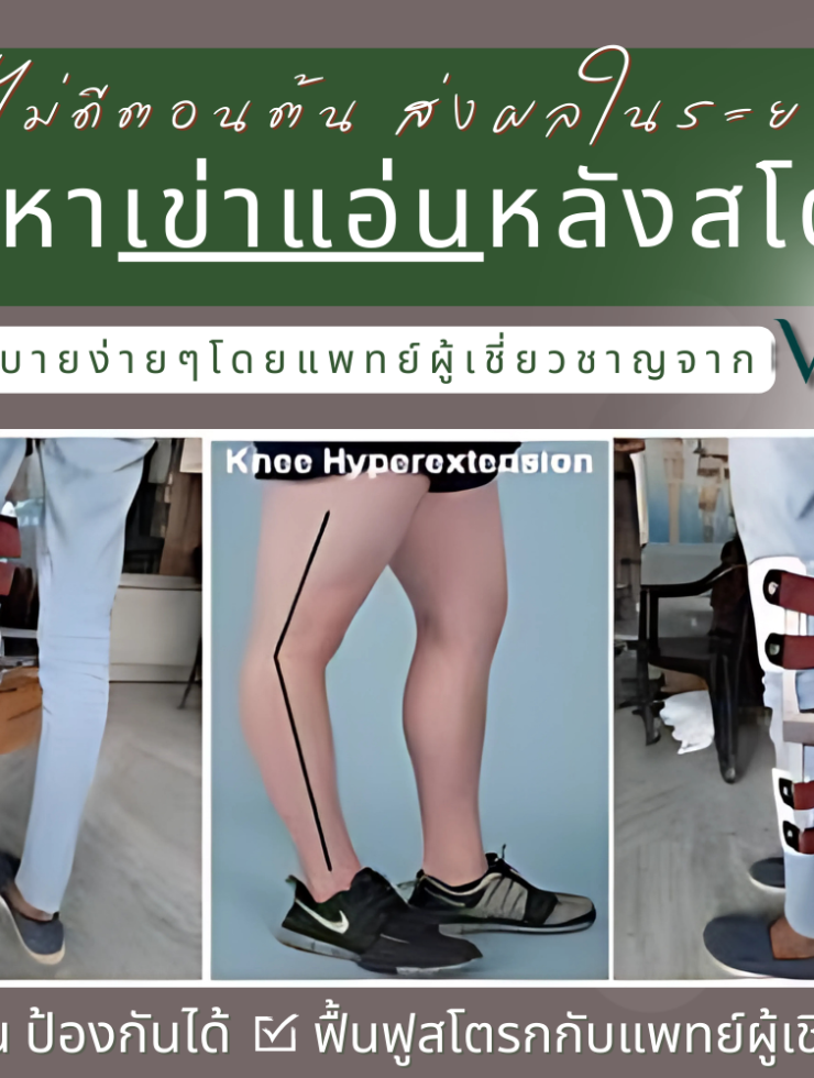 ผลเสียในระยะยาวของภาวะเข่าแอ่นในคนไข้สโตรก