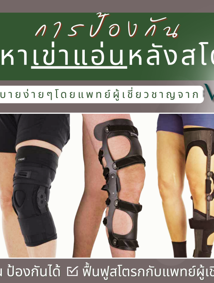 การป้องกันภาวะเข่าแอ่นในคนไข้สโตรก