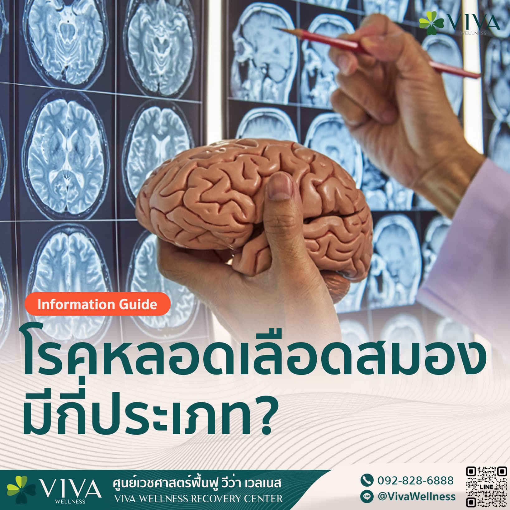 โรคหลอดเลือดสมอง-มี่กี่ประเภท